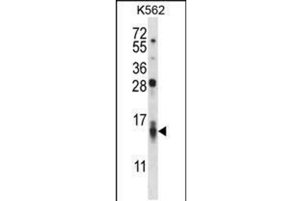 anti-Chemokine (C-C Motif) Ligand 15 (CCL15) (AA 71-100), (C-Term) antibody