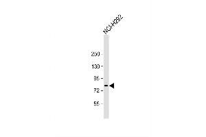 Image no. 2 for anti-Zinc Finger Protein 12 (ZNF12) (AA 102-128), (N-Term) antibody (ABIN1882014)