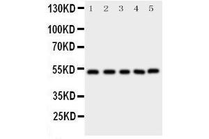 Image no. 3 for anti-SMAD, Mothers Against DPP Homolog 5 (SMAD5) (AA 248-267), (Middle Region) antibody (ABIN3043980)