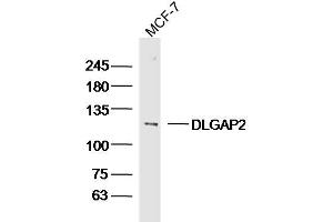 Image no. 2 for anti-Discs, Large (Drosophila) Homolog-Associated Protein 2 (DLGAP2) (AA 251-360) antibody (ABIN1386703)