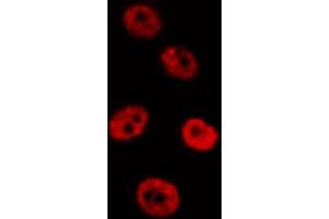 Image no. 3 for anti-SMAD, Mothers Against DPP Homolog 2 (SMAD2) (pSer467) antibody (ABIN6256347)