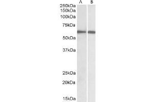 Image no. 4 for anti-Interferon Regulatory Factor 5 (IRF5) (C-Term) antibody (ABIN184812)