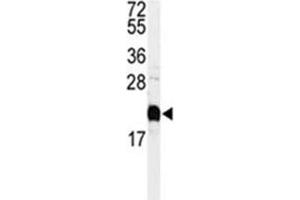 Image no. 3 for anti-Calmodulin 1 (Calm1) (AA 117-149) antibody (ABIN3030265)