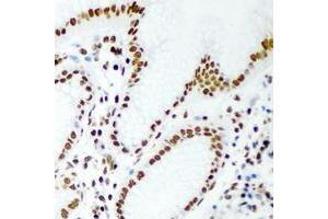 Image no. 2 for anti-Retinoblastoma Binding Protein 7 (RBBP7) (full length) antibody (ABIN6005506)
