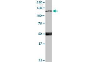 Image no. 2 for anti-Microtubule Associated Tumor Suppressor 1 (MTUS1) (AA 1-240) antibody (ABIN566122)