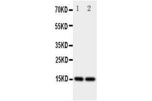 Image no. 1 for anti-Fatty Acid Binding Protein 5 (Psoriasis-Associated) (FABP5) (AA 10-23), (N-Term) antibody (ABIN3044084)