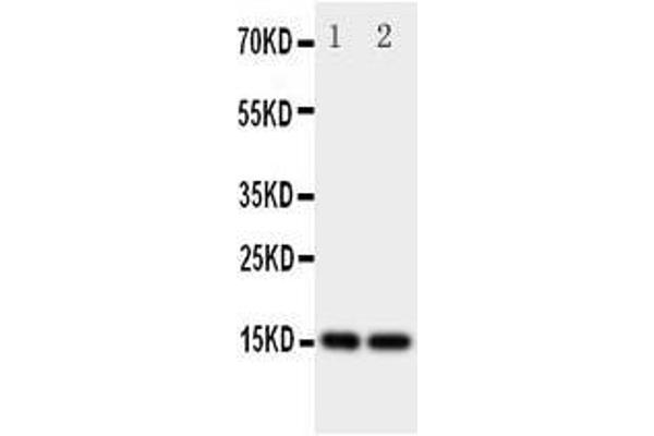 anti-Fatty Acid Binding Protein 5 (Psoriasis-Associated) (FABP5) (AA 10-23), (N-Term) antibody