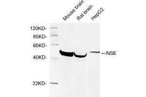 Image no. 2 for anti-Enolase 2 (Gamma, Neuronal) (ENO2) (N-Term) antibody (ABIN1574103)