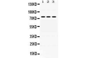 ACSL1 anticorps  (AA 604-698)