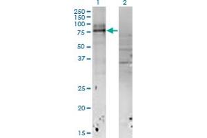 Image no. 2 for anti-Interleukin 18 Receptor Accessory Protein (IL18RAP) (AA 20-129) antibody (ABIN522252)