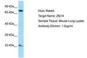 Image no. 1 for anti-Zinc Finger Protein 569 (ZNF569) (C-Term) antibody (ABIN6749864)