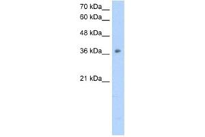 Image no. 1 for anti-Ornithine Carbamoyltransferase (OTC) (N-Term) antibody (ABIN629690)