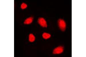 Image no. 3 for anti-MutY Homolog (E. Coli) (MUTYH) (Center) antibody (ABIN2706618)