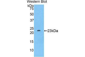 Image no. 1 for anti-Sialic Acid Binding Ig-Like Lectin 12 (SIGLEC12) (AA 317-512) antibody (ABIN1860552)