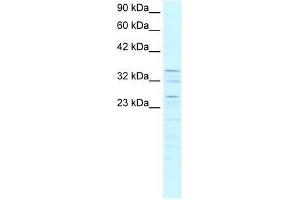 Image no. 1 for anti-Zinc Finger Protein 385A (ZNF385A) (C-Term) antibody (ABIN927338)