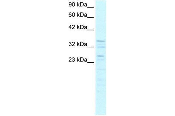 ZNF385A Antikörper  (C-Term)