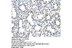 Image no. 1 for anti-Protein Arginine Methyltransferase 5 (PRMT5) (N-Term) antibody (ABIN2778654)