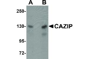 Image no. 1 for anti-Microtubule-associated Tumor Suppressor Candidate 2 (MTUS2) (C-Term) antibody (ABIN6656002)