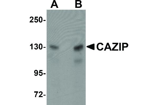 anti-Microtubule-associated Tumor Suppressor Candidate 2 (MTUS2) (C-Term) antibody