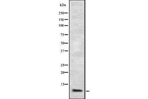 Image no. 1 for anti-Chemokine (C-C Motif) Ligand 3 (CCL3) (Internal Region) antibody (ABIN6263256)