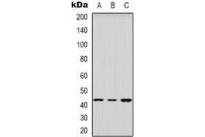 Image no. 1 for anti-Hydroxy-delta-5-Steroid Dehydrogenase, 3 beta- and Steroid delta-Isomerase 2 (HSD3B2) antibody (ABIN2957624)