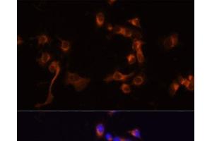 Immunofluorescence analysis of A431 cells using ABL1 Polyclonal Antibody at dilution of 1:100 (40x lens).