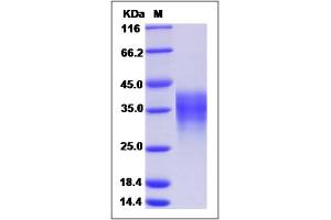 Image no. 2 for Leukemia Inhibitory Factor (LIF) (AA 1-202) (Active) protein (ABIN2006363)