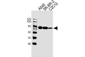 Image no. 1 for anti-Calpain 2 (CAPN2) antibody (ABIN4907387)