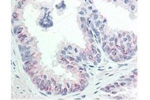 Image no. 6 for anti-V-Akt Murine Thymoma Viral Oncogene Homolog 1 (AKT1) (pSer473) antibody (ABIN964561)