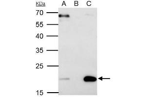 IP Image Sorcin antibody [N1C3] immunoprecipitates Sorcin protein in IP experiments.