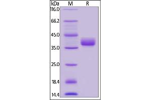 Image no. 1 for CD52 (CD52) (AA 25-36) (Active) protein (Fc Tag) (ABIN6253630)