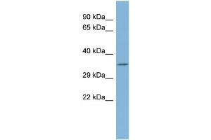 anti-Tetratricopeptide Repeat Domain 35 (TTC35) (Middle Region) antibody
