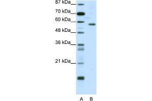 Image no. 1 for anti-YY1 Transcription Factor (YY1) (N-Term) antibody (ABIN2780503)