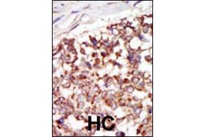 Image no. 2 for anti-P21-Activated Kinase 4 (PAK4) (AA 156-187), (N-Term) antibody (ABIN392437)