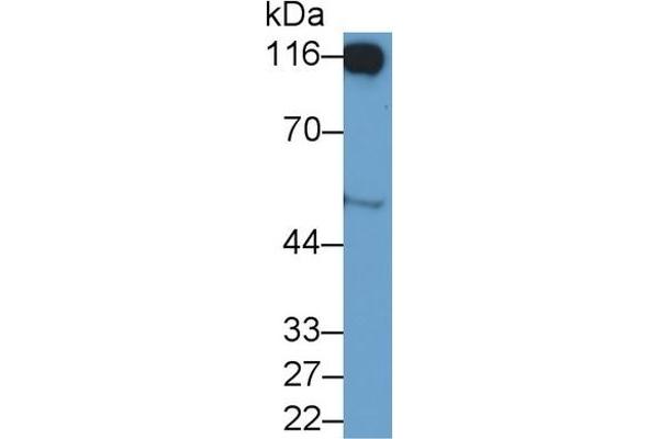 DPP4 抗体  (AA 484-728)