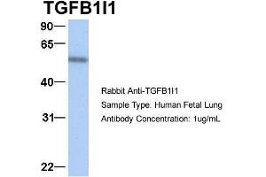 Image no. 4 for anti-Transforming Growth Factor beta 1 Induced Transcript 1 (TGFB1I1) (Middle Region) antibody (ABIN2777947)