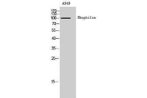 Image no. 1 for anti-Rhophilin, rho GTPase Binding Protein 1 (RHPN1) (Internal Region) antibody (ABIN3186760)