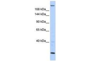 Image no. 1 for anti-Trinucleotide Repeat Containing 6B (TNRC6B) (AA 396-445) antibody (ABIN6743011)