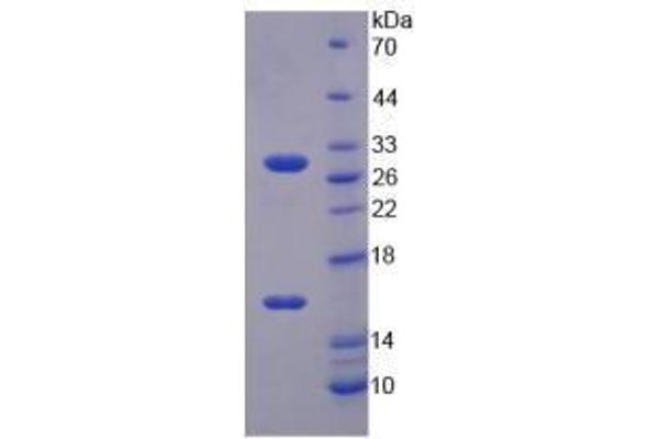 Sirtuin 3 (SIRT3) (AA 5-257) (Active) protein (His tag)