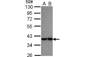 Image no. 2 for anti-Interferon Regulatory Factor 9 (IRF9) (AA 171-393) antibody (ABIN1498905)