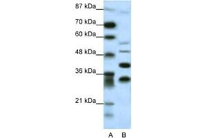 Image no. 1 for anti-Growth Factor Independent 1 (GFI1) (N-Term) antibody (ABIN2777468)