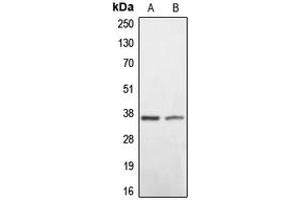 Image no. 2 for anti-BCL2/adenovirus E1B 19kDa Interacting Protein 2 (BNIP2) (C-Term) antibody (ABIN2704537)