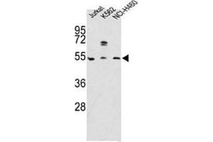 Image no. 2 for anti-Apolipoprotein A-IV (APOA4) (AA 49-79) antibody (ABIN3029992)