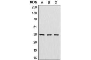 Image no. 1 for anti-Cathepsin L2 (CTSL2) (Center) antibody (ABIN2705709)