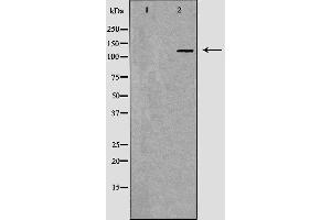 Image no. 1 for anti-MutS Homolog 3 (MSH3) (N-Term) antibody (ABIN6263385)