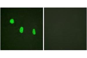 Image no. 2 for anti-CCAAT/enhancer Binding Protein (C/EBP), epsilon (CEBPE) (AA 40-89), (pThr74) antibody (ABIN1531527)