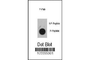 Image no. 1 for anti-Mitogen-Activated Protein Kinase-Activated Protein Kinase 2 (MAPKAPK2) (pSer272) antibody (ABIN389585)