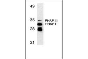 Image no. 2 for anti-Acidic (Leucine-Rich) Nuclear phosphoprotein 32 Family, Member A (ANP32A) (C-Term) antibody (ABIN500481)