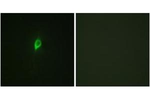 Immunofluorescence analysis of NIH-3T3 cells, using eIF4B (Phospho-Ser422) Antibody.