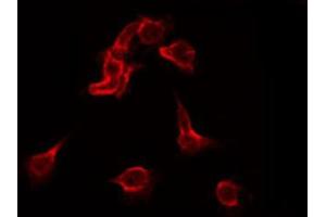 Image no. 1 for anti-Fms-Related tyrosine Kinase 1 (VEGFR1) (FLT1) (pTyr1213) antibody (ABIN6256626)